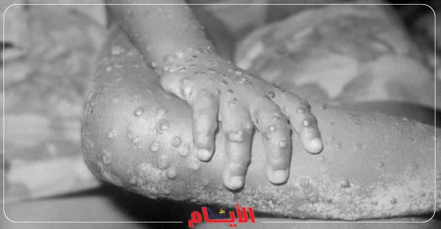 الصحة